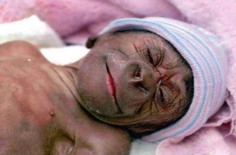 Nhiều người cho rằng humanzee có số cặp nhiễm sắc thể là 47, thay vì 23 như người và 24 như tinh tinh.